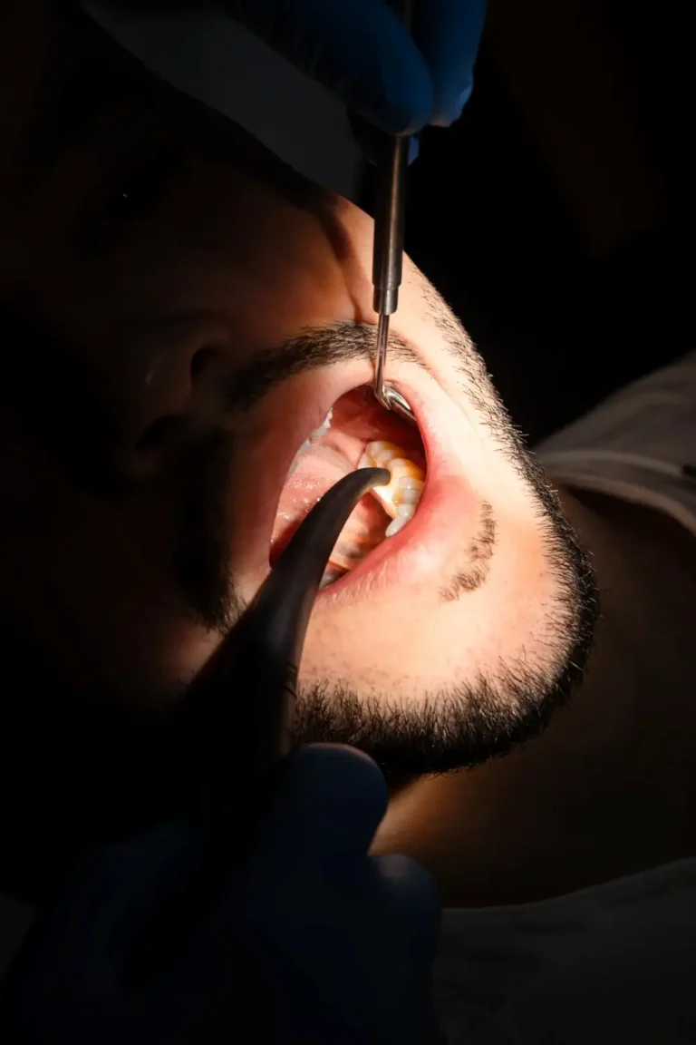 Kiedy warto rozważyć usunięcie ósemki-usuwanie ósemki w Lublinie-Klinika Pięknego Uśmiechu