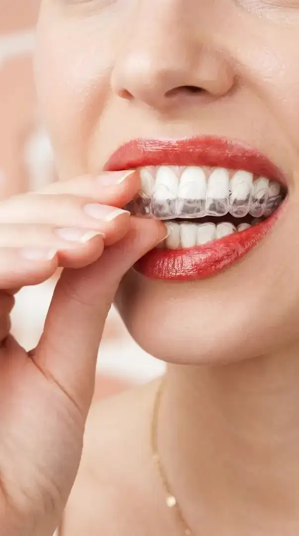 Szyna relaksacyjna w leczeniu bruksizmu-bruksizm Lublin-Klinika Pięknego Uśmiechu-1