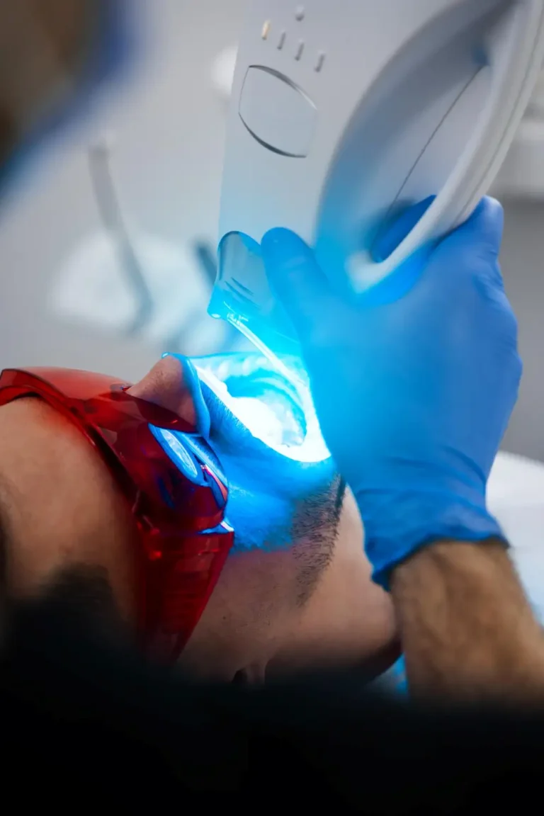 Wybielanie gabinetowe zębów w Lublinie-równomierne rozjaśnienie uśmiechu-Klinika Pięknego Uśmiechu-dr Marzena Pucek