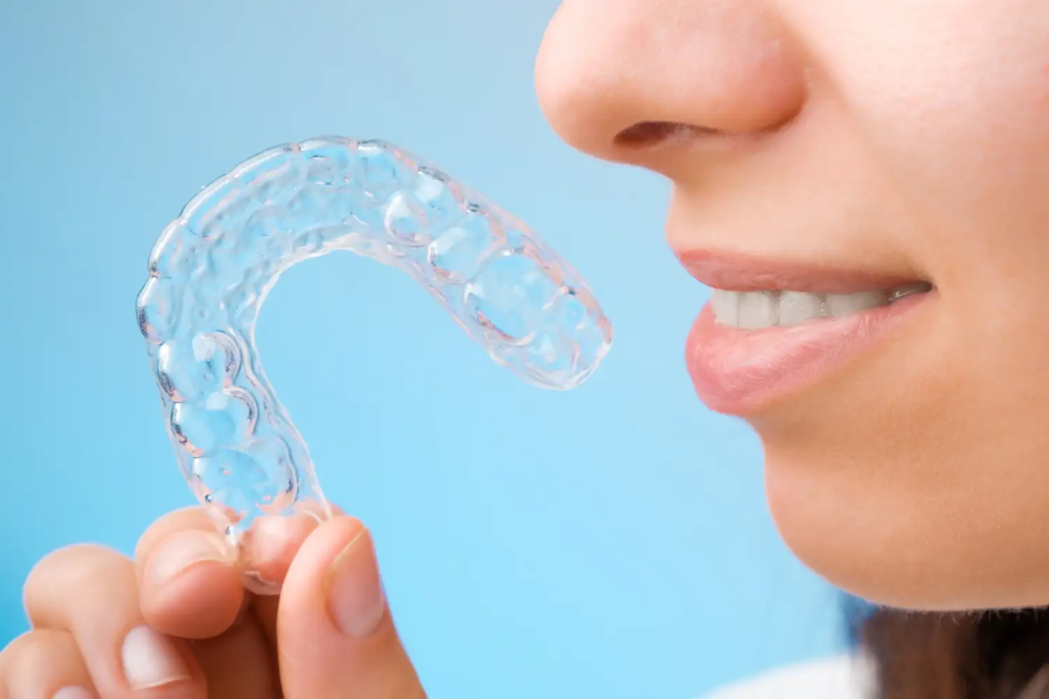 Przezroczyste nakładki ortodontyczne Invisalign stosowane w leczeniu wad zgryzu w Lublinie